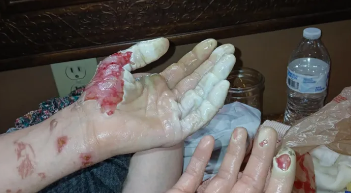 Tough times continue for Plevna woman
